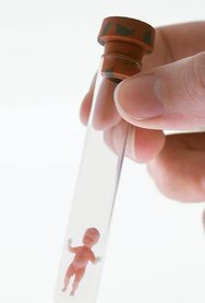 郑州做一次试管婴儿费用大概多少？