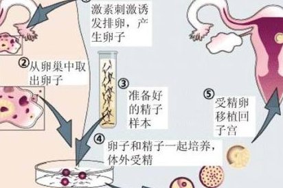 衡阳本地做试管婴儿去南华附一还是附二星辉生殖中心？